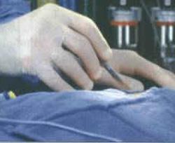 necrosectomia [http://image.ig.com.br/v5/midias/0321001-0321500/321219.jpg]