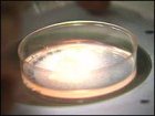 coltura [http://www.molecularlab.it/public/news/_dish.jpg]